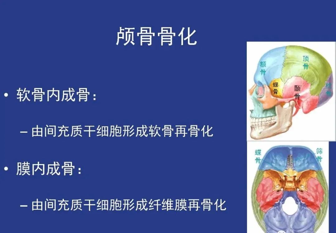 影像PPT - 【PPT】颅穹隆骨正常及常见变异的影像学表现-5