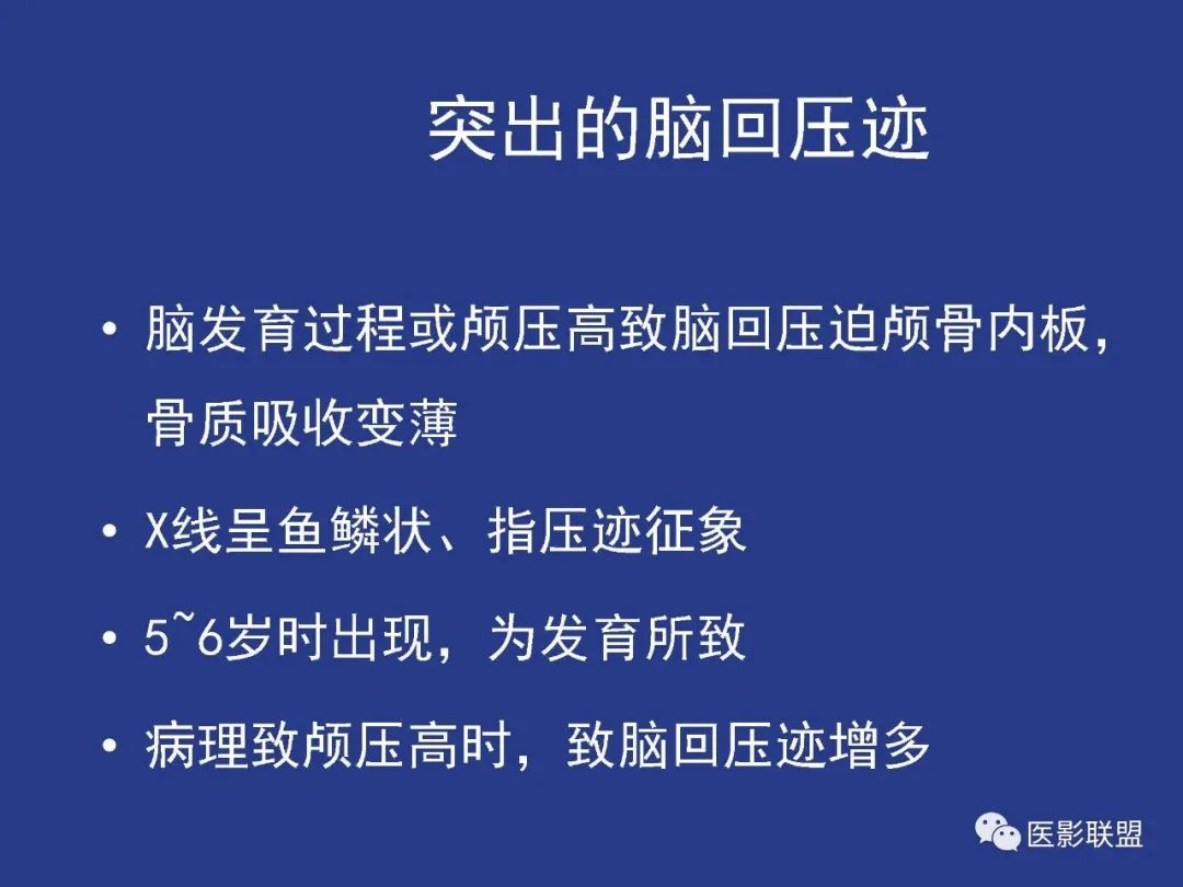 影像PPT - 【PPT】颅穹隆骨正常及常见变异的影像学表现-63