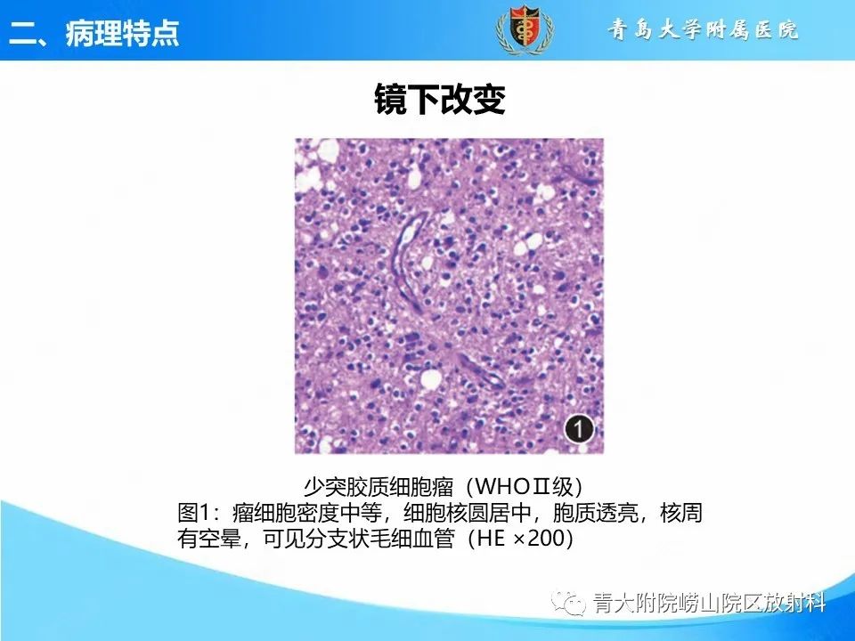 影像PPT - 【PPT】少突胶质细胞肿瘤的影像诊断与鉴别-10