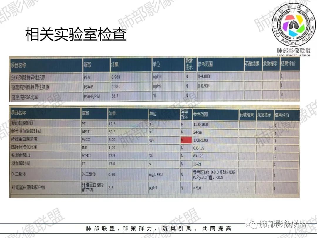 影像PPT - 【病例】 肉包骨,是骨淋巴瘤的特征吗?-3 影像PPT - 【病例】 肉包骨,是骨淋巴瘤的特征吗?-3