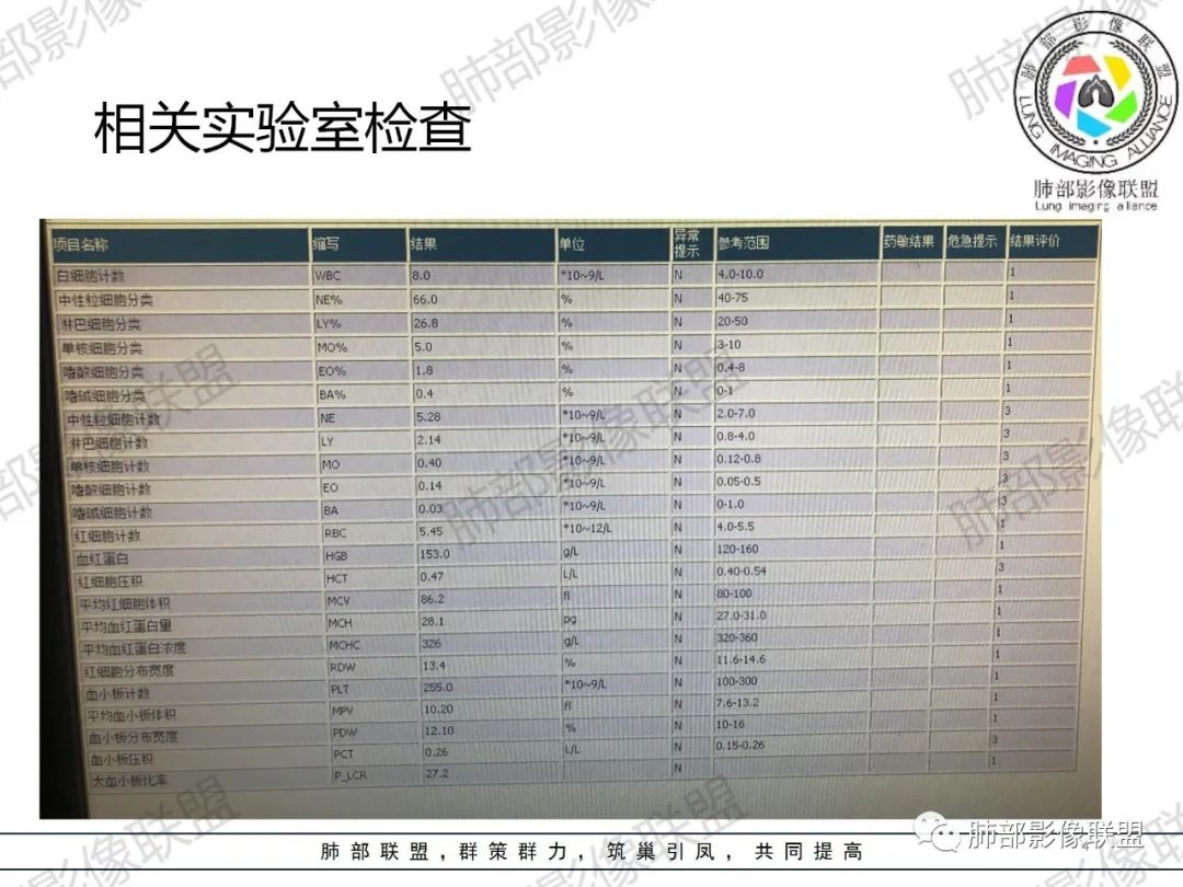 影像PPT - 【病例】 肉包骨,是骨淋巴瘤的特征吗?-4 影像PPT - 【病例】 肉包骨,是骨淋巴瘤的特征吗?-4