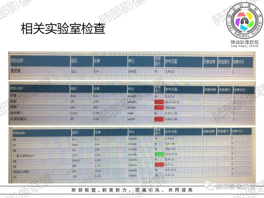 影像PPT - 【病例】 肉包骨,是骨淋巴瘤的特征吗?-6 影像PPT - 【病例】 肉包骨,是骨淋巴瘤的特征吗?-6