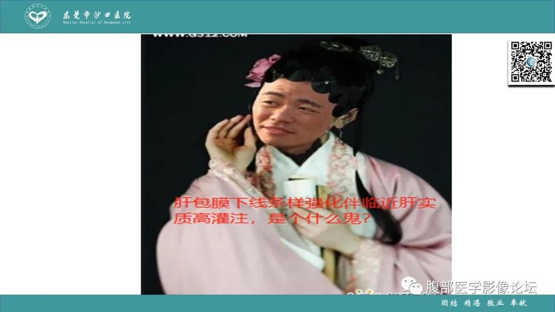 影像PPT - 【PPT】Fitz-Hugh-Curtis综合征 (FHCS)-9