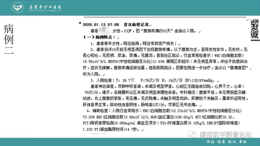 影像PPT - 【PPT】Fitz-Hugh-Curtis综合征 (FHCS)-10