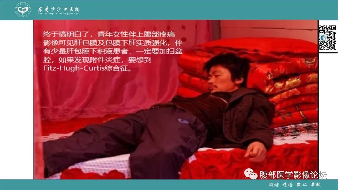 影像PPT - 【PPT】Fitz-Hugh-Curtis综合征 (FHCS)-44