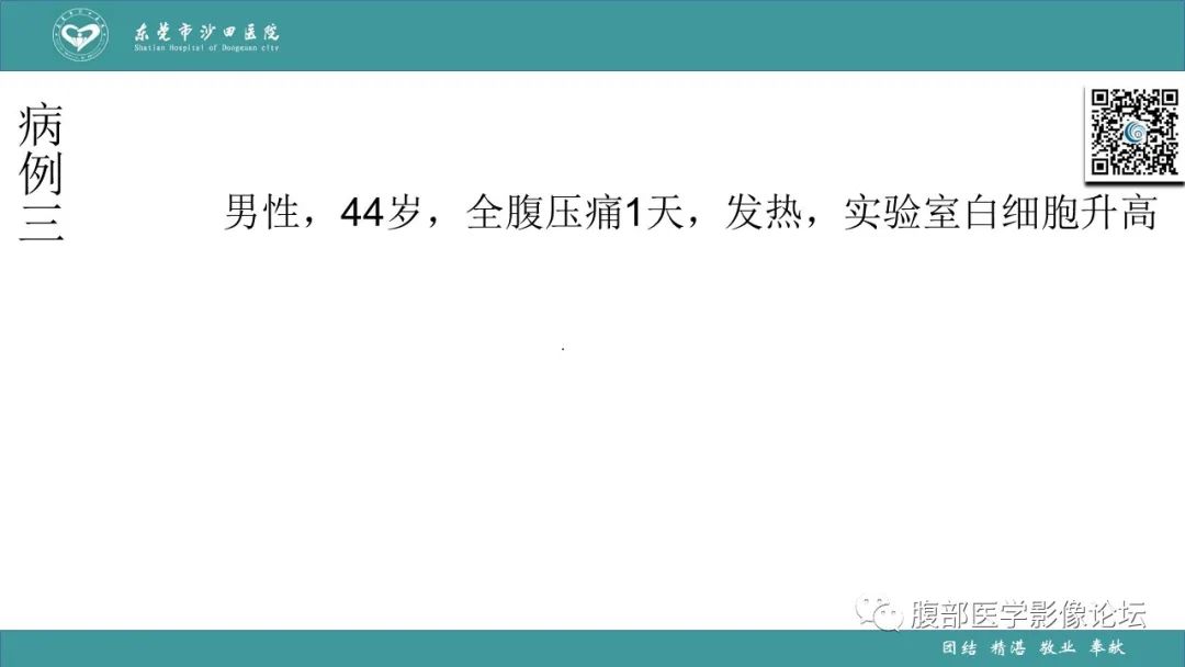 影像PPT - 【PPT】Fitz-Hugh-Curtis综合征 (FHCS)-45