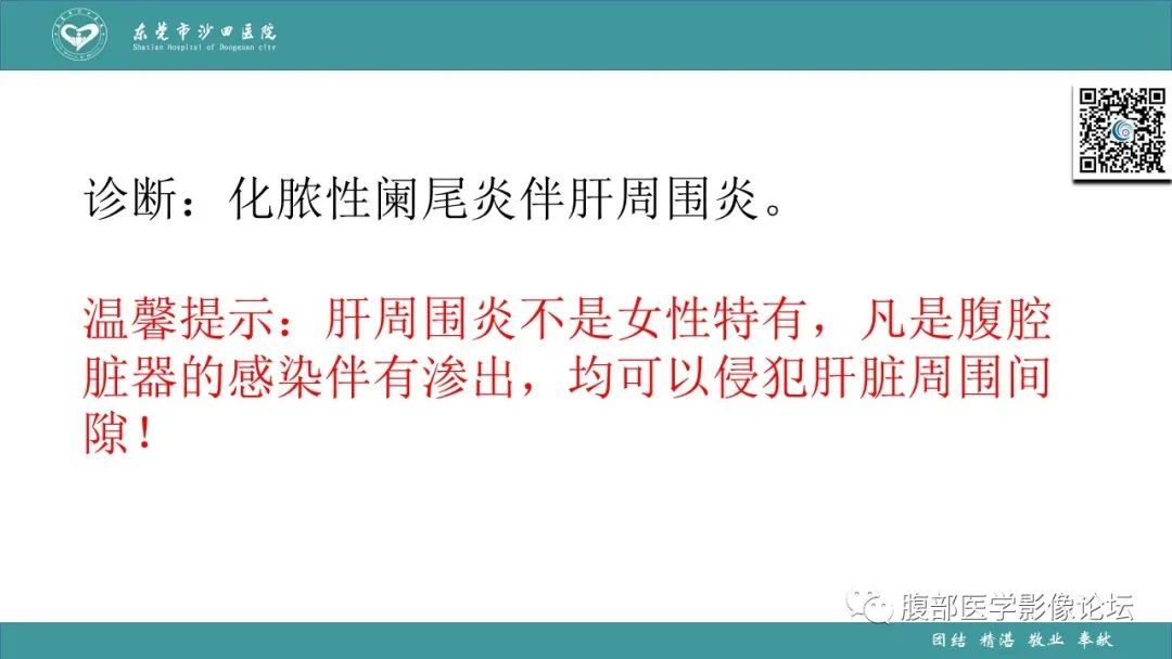 影像PPT - 【PPT】Fitz-Hugh-Curtis综合征 (FHCS)-47