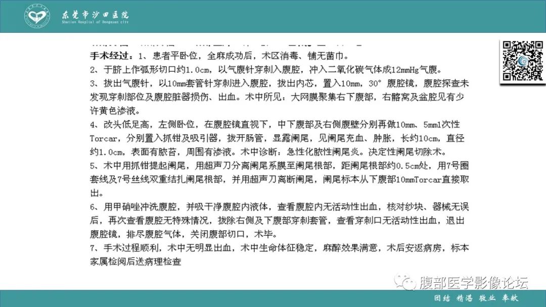 影像PPT - 【PPT】Fitz-Hugh-Curtis综合征 (FHCS)-48