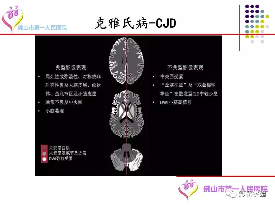 影像PPT - 【PPT】脑皮层区病变诊断及鉴别鉴别-28