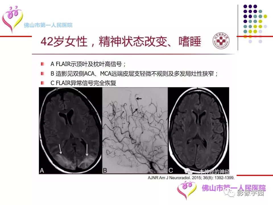 影像PPT - 【PPT】脑皮层区病变诊断及鉴别鉴别-77