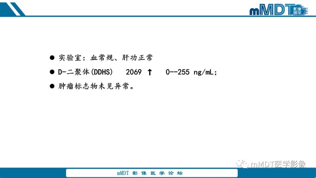 影像PPT - 【病例】胃神经鞘瘤1例CT读片分析-3