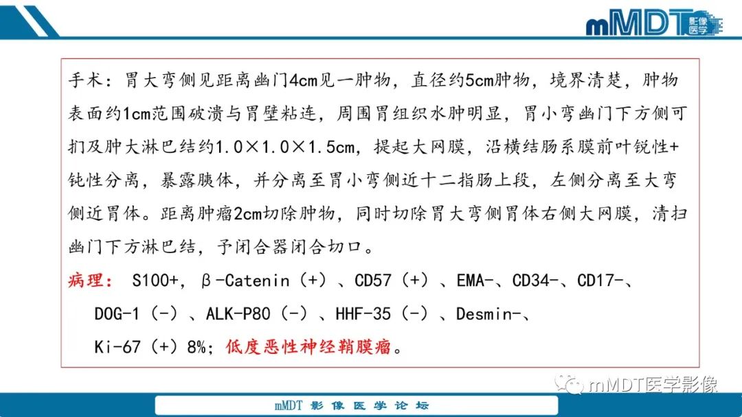 影像PPT - 【病例】胃神经鞘瘤1例CT读片分析-22
