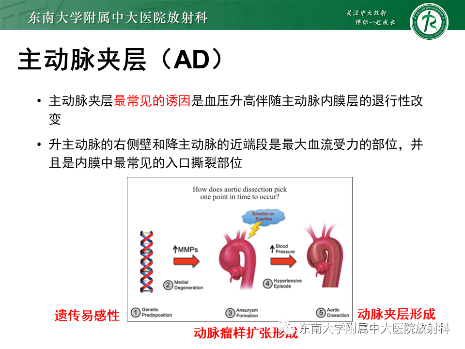 影像PPT - 【PPT】急性主动脉综合征-5