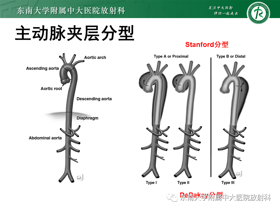 影像PPT - 【PPT】急性主动脉综合征-7