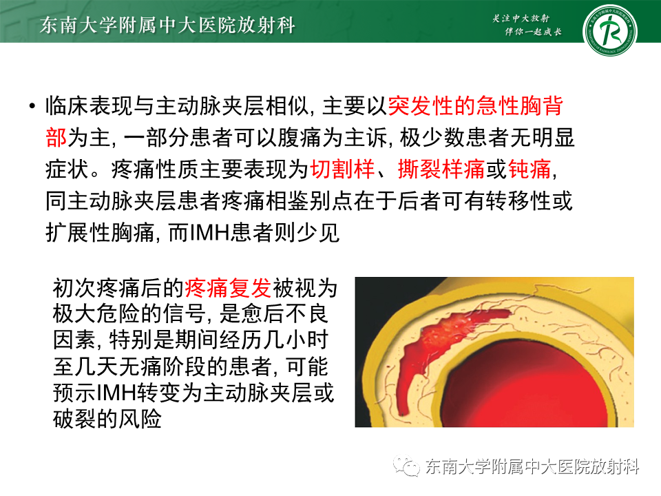 影像PPT - 【PPT】急性主动脉综合征-13