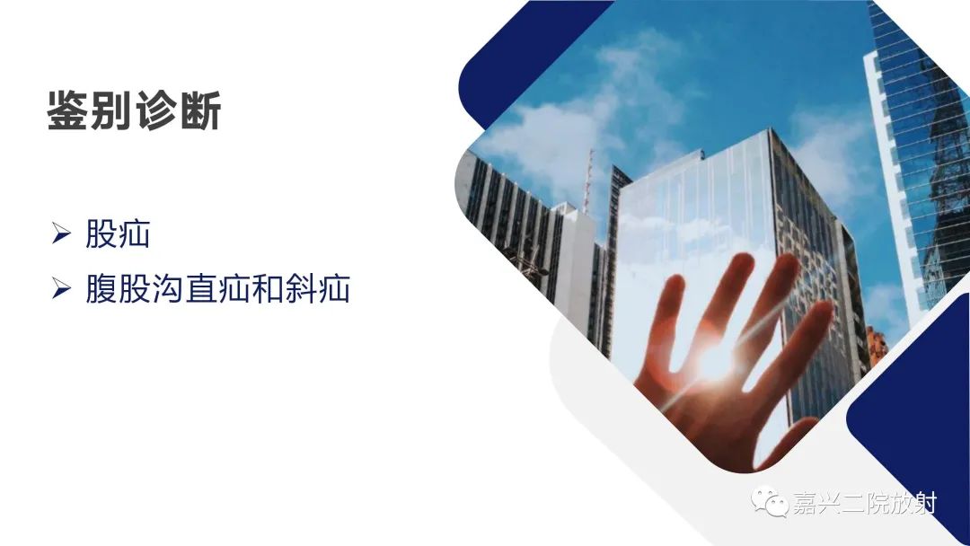 影像PPT - 【PPT】闭孔疝CT表现-14