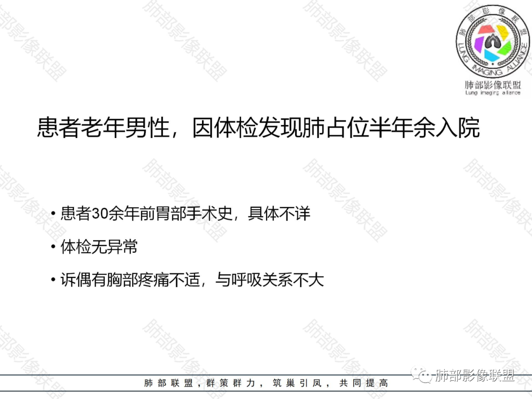 影像PPT - 【病例】肺内淋巴瘤1例CT影像表现-2 影像PPT - 【病例】肺内淋巴瘤1例CT影像表现-2