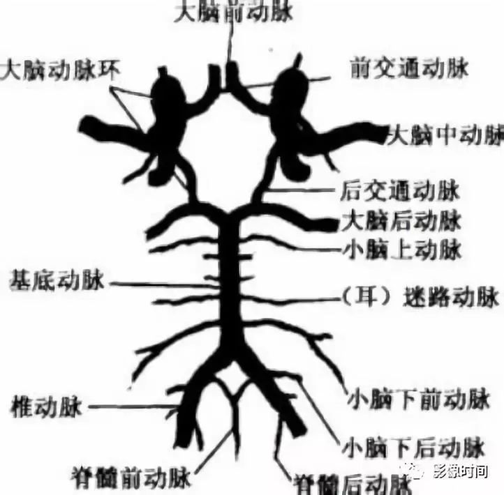 影像PPT - 8 个病例带您一起复习颅内动脉瘤这些知识-1