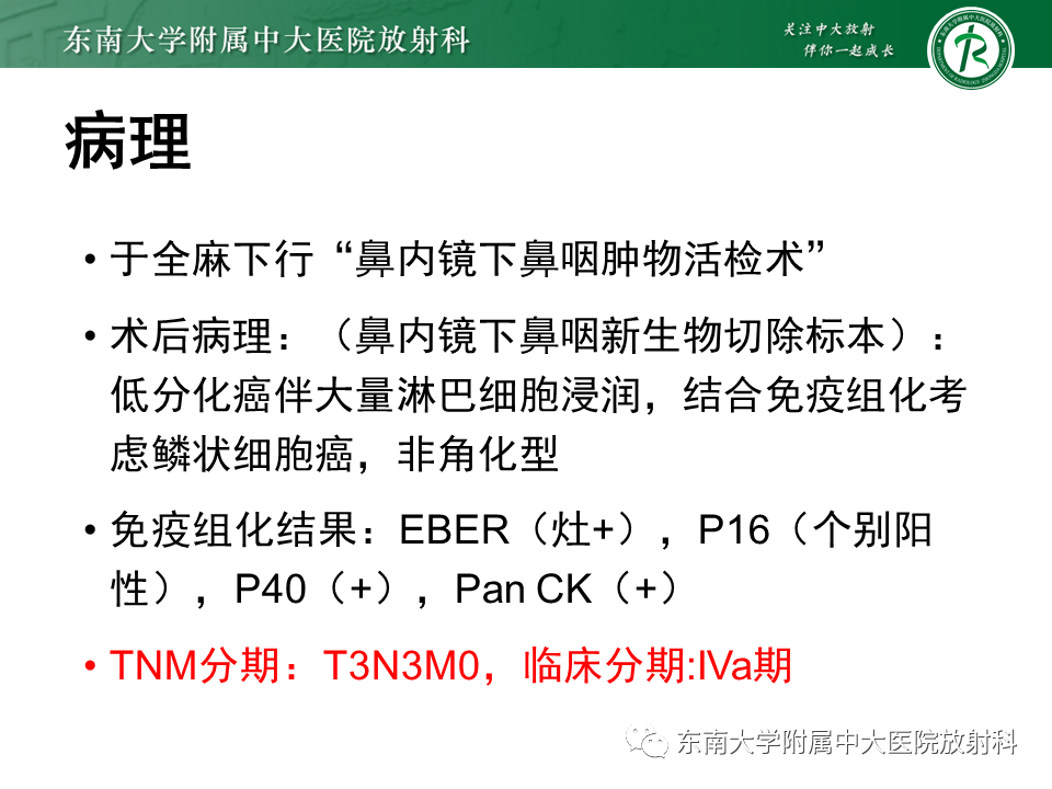 影像PPT - 【PPT】鼻咽癌的影像-2 影像PPT - 【PPT】鼻咽癌的影像-2