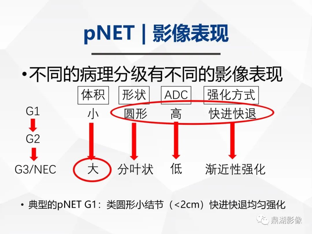 影像PPT - 【病例】胰腺神经内分泌肿瘤不典型病例1例CT及MR影像-26