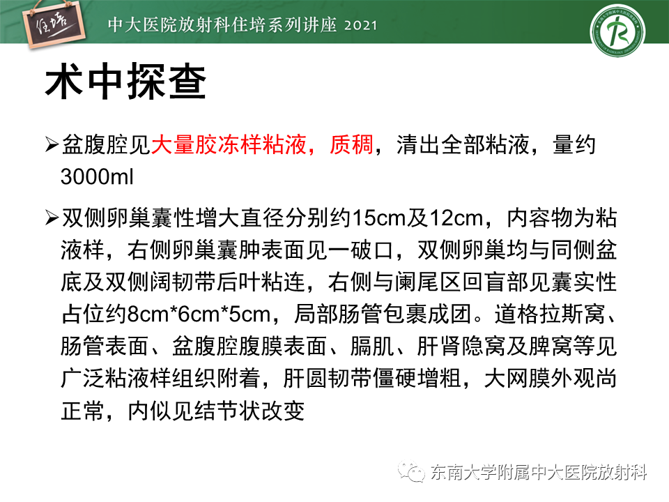 影像PPT - 【PPT】卵巢原发及继发粘液性肿瘤分析思路-16