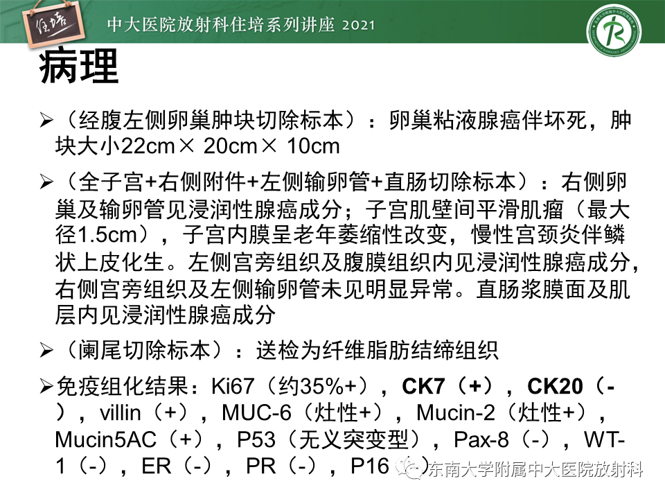 影像PPT - 【PPT】卵巢原发及继发粘液性肿瘤分析思路-19
