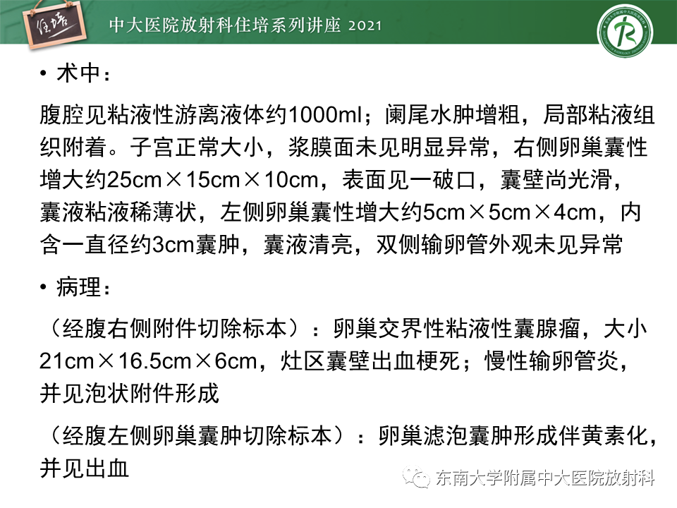 影像PPT - 【PPT】卵巢原发及继发粘液性肿瘤分析思路-30