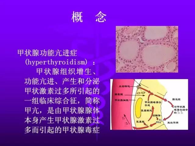 影像PPT - 11种常见代谢性骨病的影像学表现-59 影像PPT - 11种常见代谢性骨病的影像学表现-59
