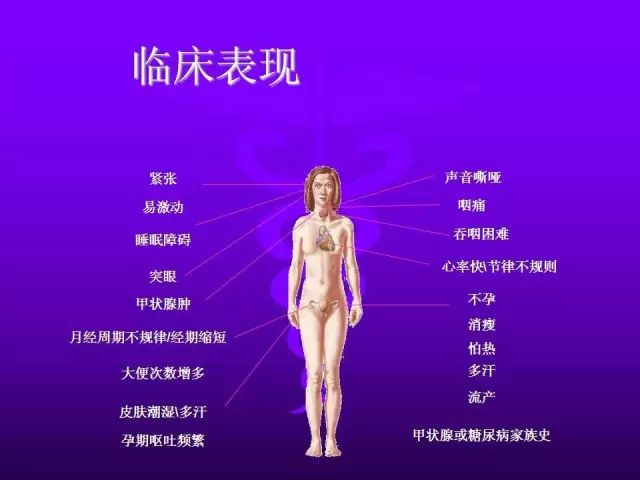 影像PPT - 11种常见代谢性骨病的影像学表现-65 影像PPT - 11种常见代谢性骨病的影像学表现-65