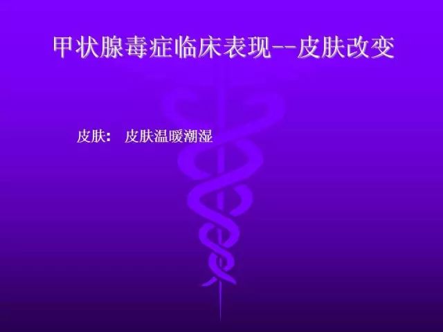 影像PPT - 11种常见代谢性骨病的影像学表现-80 影像PPT - 11种常见代谢性骨病的影像学表现-80