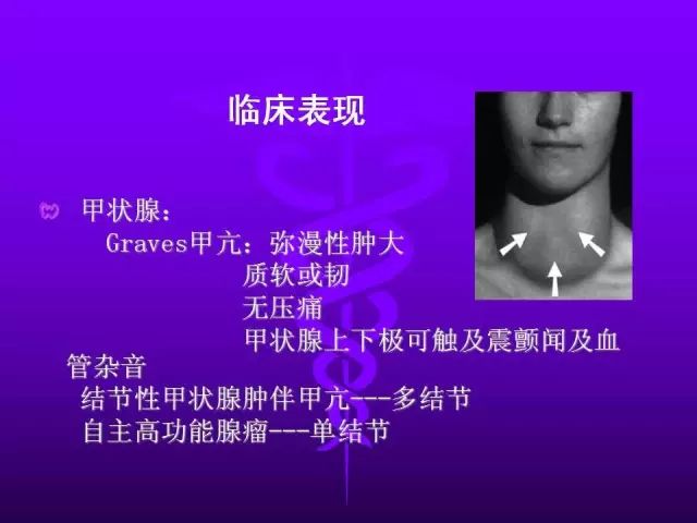 影像PPT - 11种常见代谢性骨病的影像学表现-82 影像PPT - 11种常见代谢性骨病的影像学表现-82