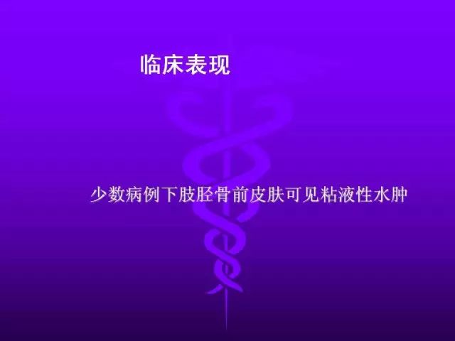 影像PPT - 11种常见代谢性骨病的影像学表现-91 影像PPT - 11种常见代谢性骨病的影像学表现-91
