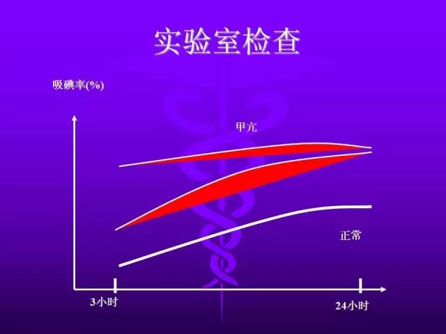 影像PPT - 11种常见代谢性骨病的影像学表现-101 影像PPT - 11种常见代谢性骨病的影像学表现-101