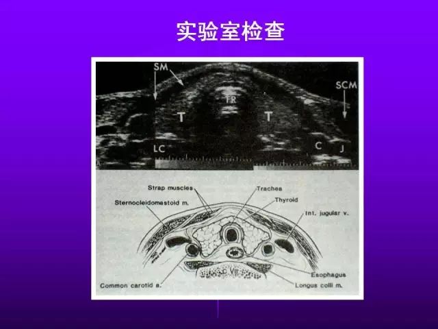 影像PPT - 11种常见代谢性骨病的影像学表现-103 影像PPT - 11种常见代谢性骨病的影像学表现-103