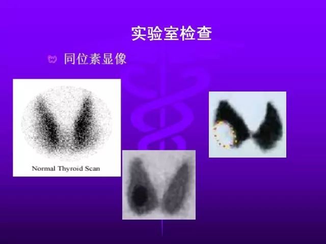 影像PPT - 11种常见代谢性骨病的影像学表现-106 影像PPT - 11种常见代谢性骨病的影像学表现-106