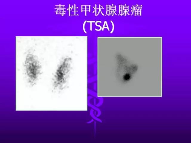 影像PPT - 11种常见代谢性骨病的影像学表现-116 影像PPT - 11种常见代谢性骨病的影像学表现-116