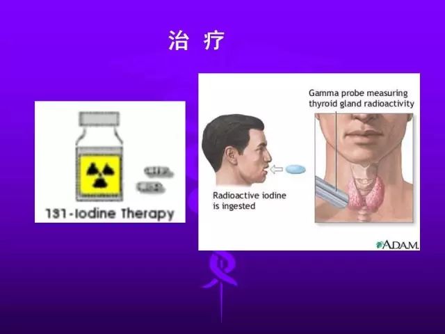影像PPT - 11种常见代谢性骨病的影像学表现-142 影像PPT - 11种常见代谢性骨病的影像学表现-142