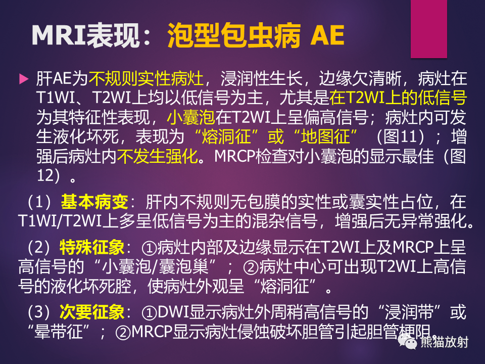 影像PPT - 【PPT】肝包虫病的影像学诊断专家共识-21