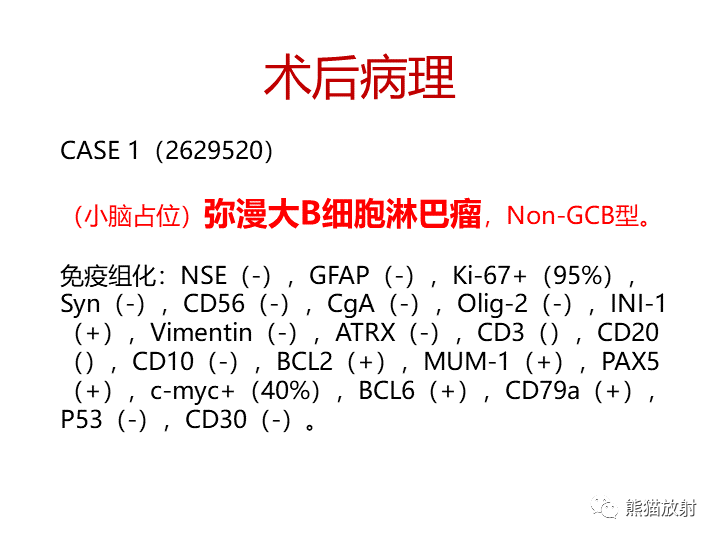 影像PPT - 【病例】小脑原发性脑淋巴瘤2例MR-15