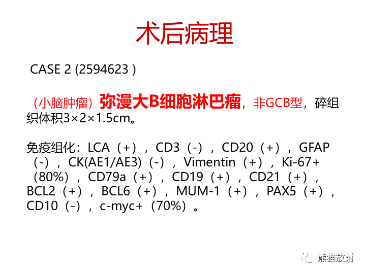 影像PPT - 【病例】小脑原发性脑淋巴瘤2例MR-16