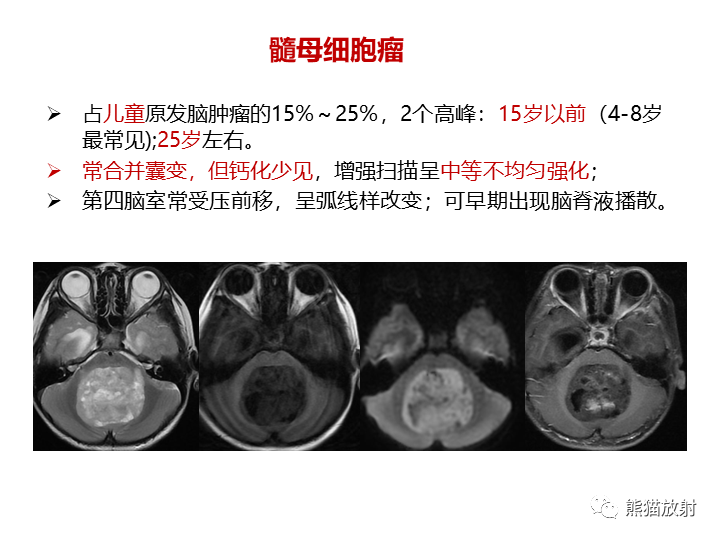 影像PPT - 【病例】小脑原发性脑淋巴瘤2例MR-29