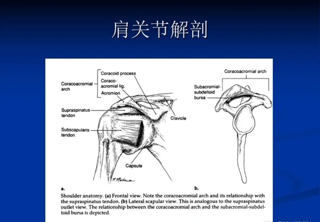 影像PPT - 肩袖解剖及损伤的临床及MRI诊断-17 影像PPT - 肩袖解剖及损伤的临床及MRI诊断-17