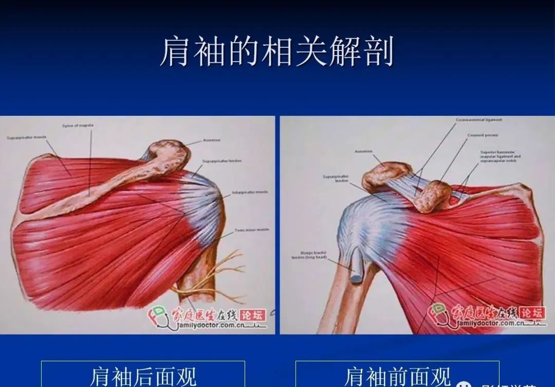 影像PPT - 肩袖解剖及损伤的临床及MRI诊断-27 影像PPT - 肩袖解剖及损伤的临床及MRI诊断-27