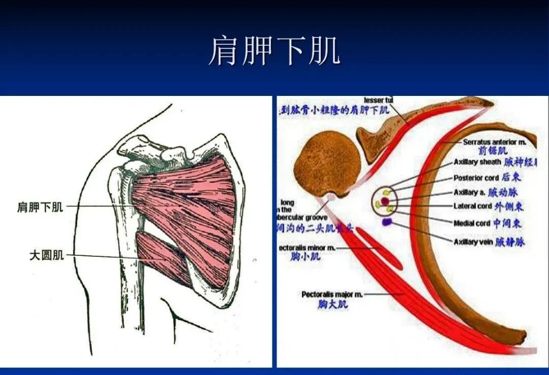 影像PPT - 肩袖解剖及损伤的临床及MRI诊断-35 影像PPT - 肩袖解剖及损伤的临床及MRI诊断-35