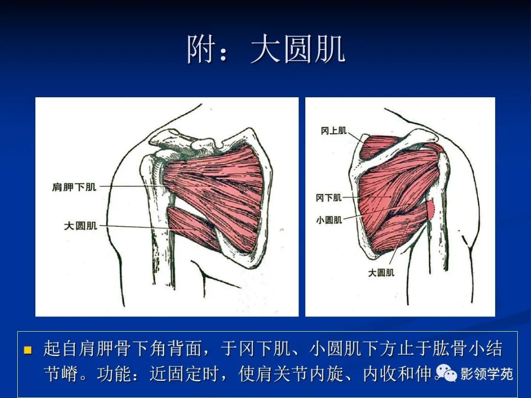 影像PPT - 肩袖解剖及损伤的临床及MRI诊断-39 影像PPT - 肩袖解剖及损伤的临床及MRI诊断-39