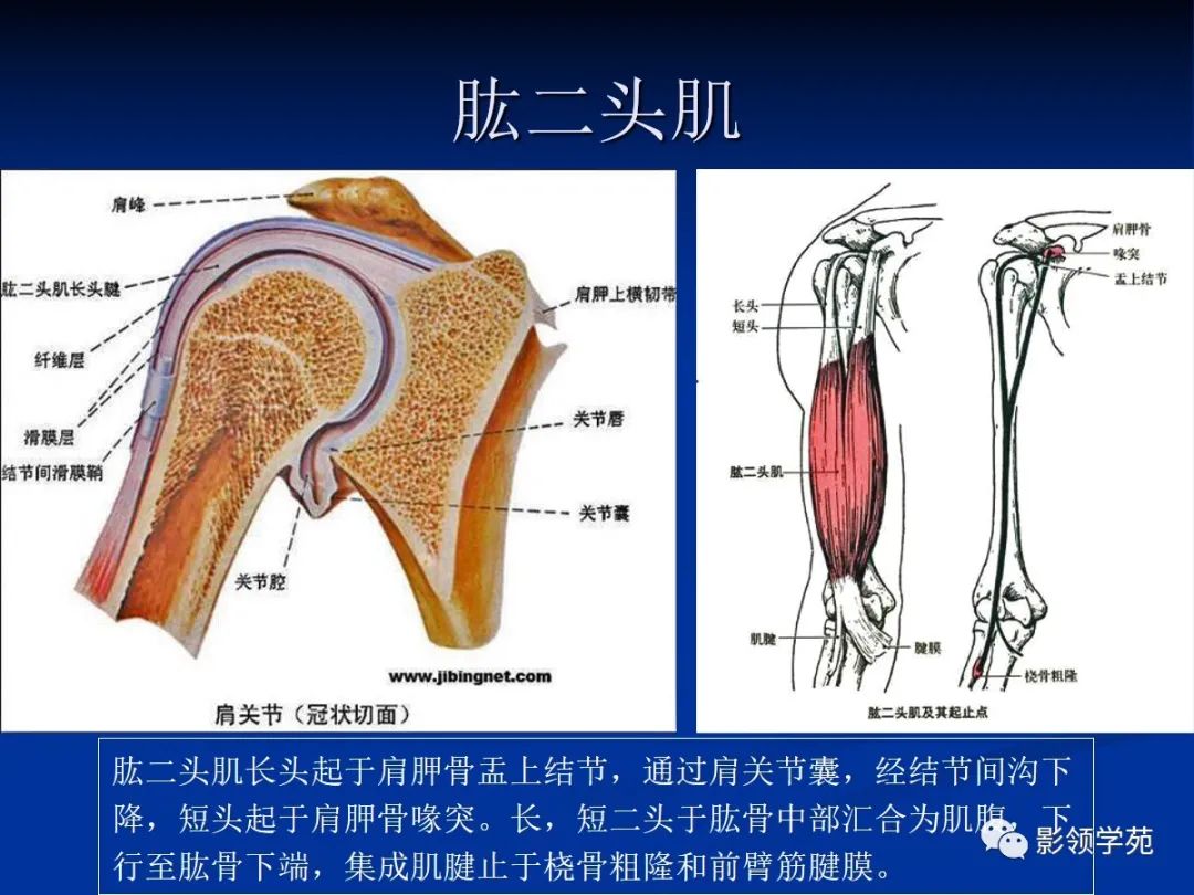 影像PPT - 肩袖解剖及损伤的临床及MRI诊断-42 影像PPT - 肩袖解剖及损伤的临床及MRI诊断-42