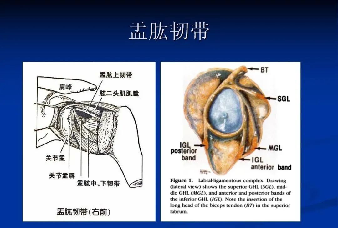 影像PPT - 肩袖解剖及损伤的临床及MRI诊断-56 影像PPT - 肩袖解剖及损伤的临床及MRI诊断-56