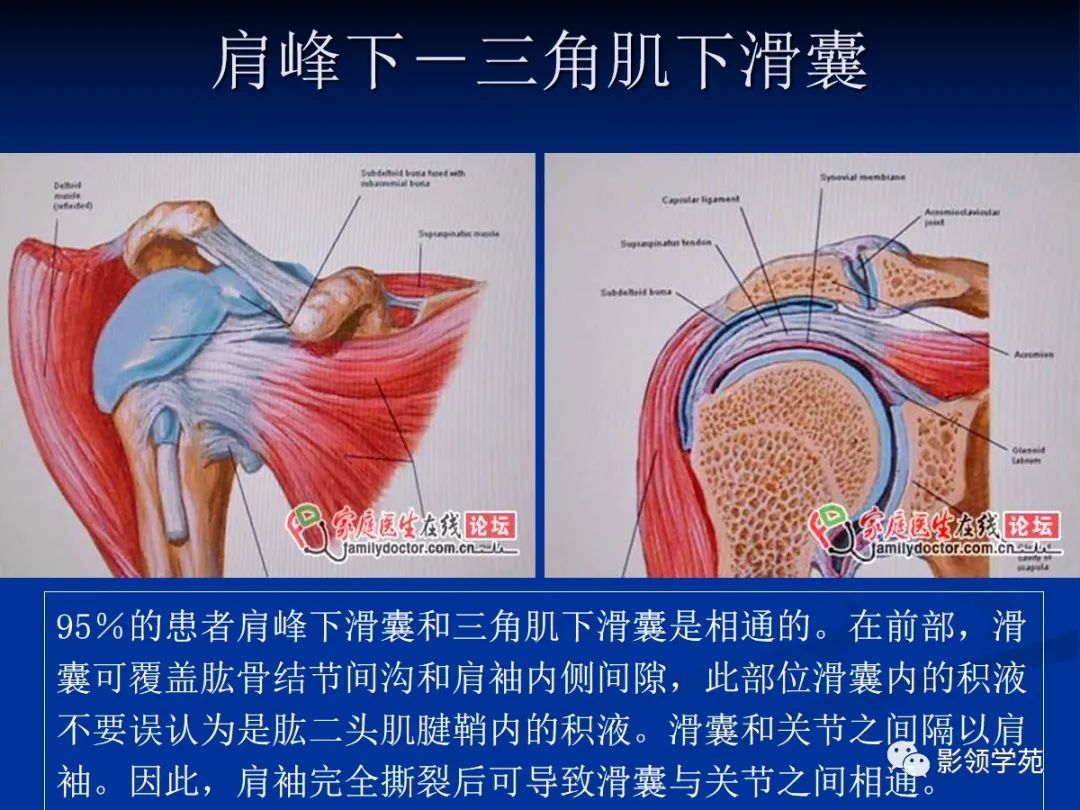 影像PPT - 肩袖解剖及损伤的临床及MRI诊断-65 影像PPT - 肩袖解剖及损伤的临床及MRI诊断-65