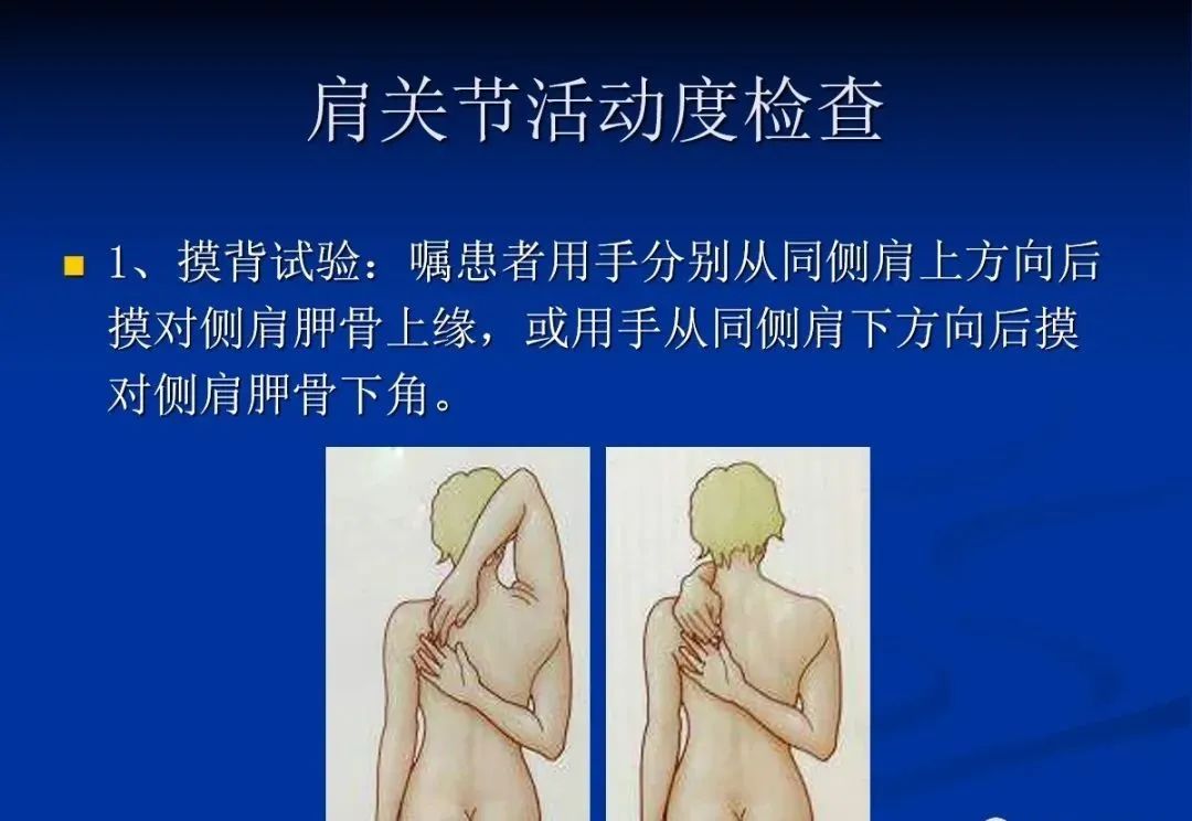 影像PPT - 肩袖解剖及损伤的临床及MRI诊断-82 影像PPT - 肩袖解剖及损伤的临床及MRI诊断-82