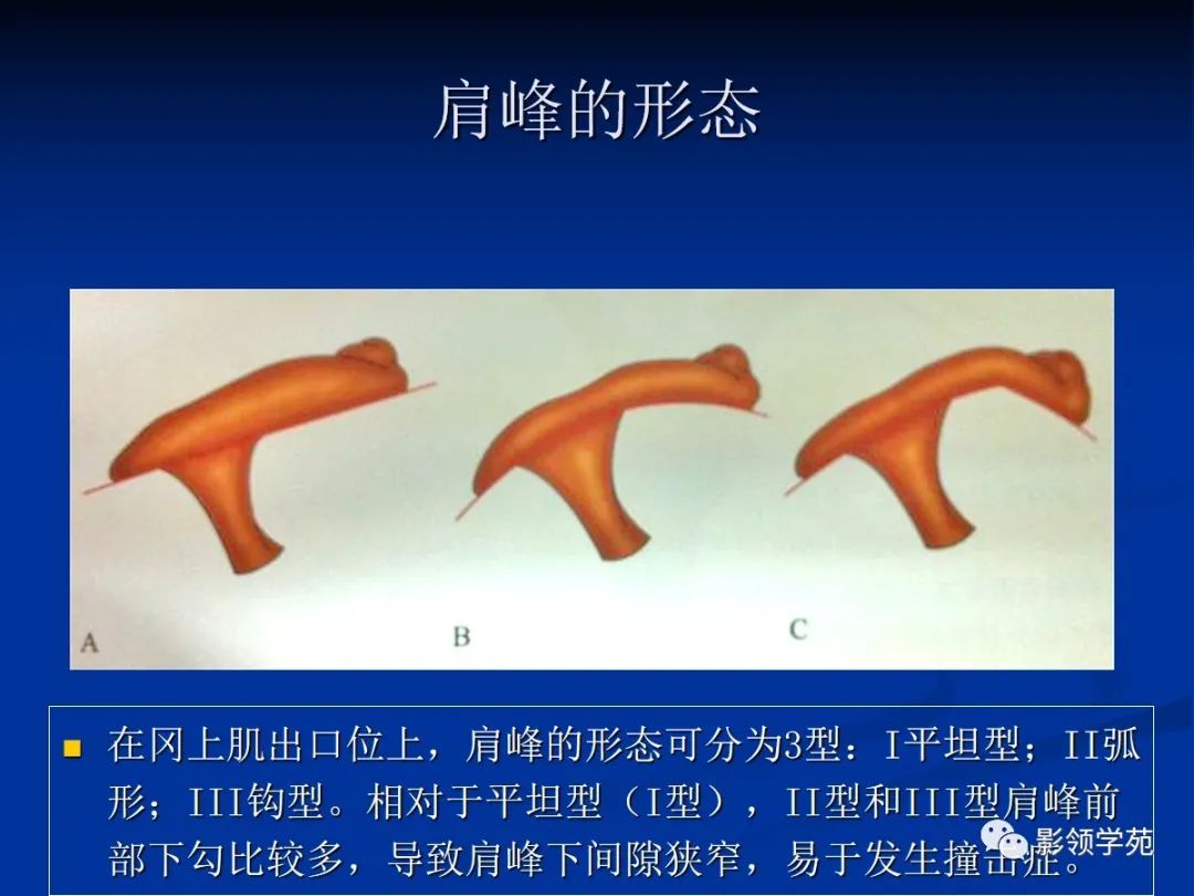 影像PPT - 肩袖解剖及损伤的临床及MRI诊断-101 影像PPT - 肩袖解剖及损伤的临床及MRI诊断-101